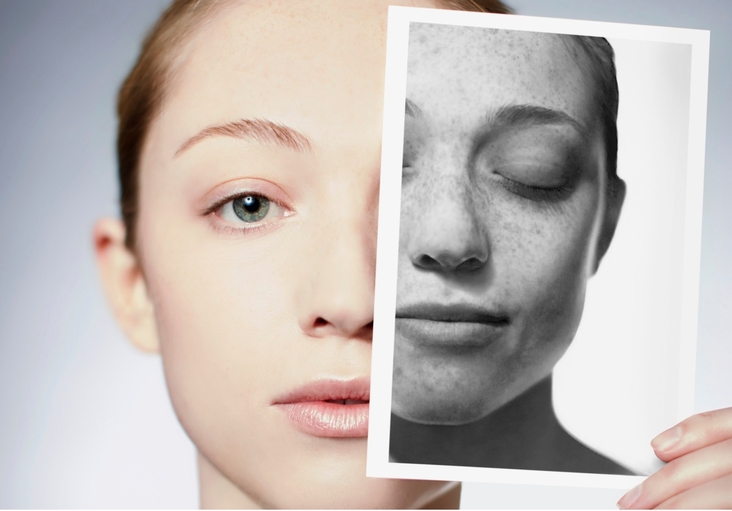 before and after skincare dermatology